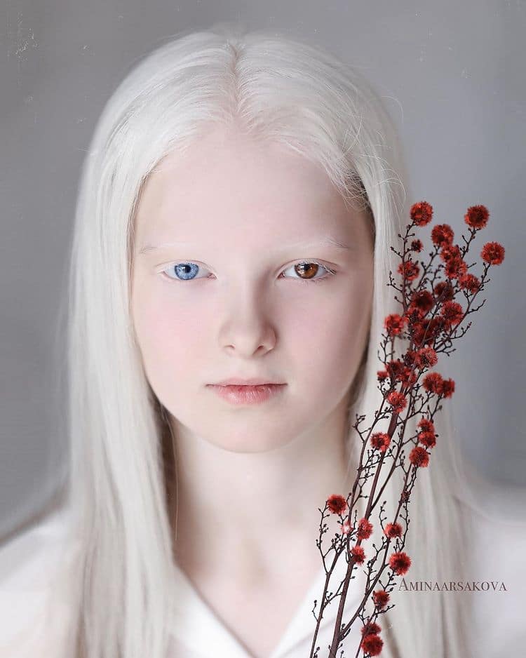 Retratos Etéreos Destacam A Beleza Única De Uma Menina Com Albinismo E Heterocromia